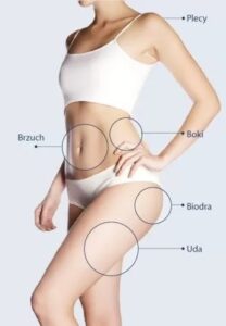 Kriolipoliza Clatuu obszary