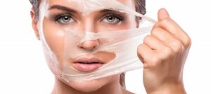 Peeling chemiczny2