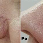 QuadroStar Pro Yellow efekty 2