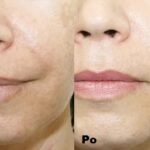Intraceuticals Boosters kolagen efekty 2
