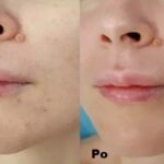 Intraceuticals - Boosters Witamina C efekty 1