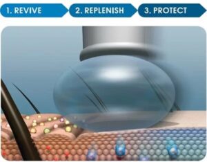 Intraceuticals - Rejuvenate