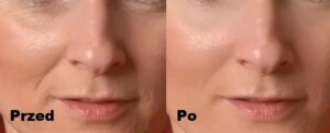 Intraceuticals Thermal Water efekty 1