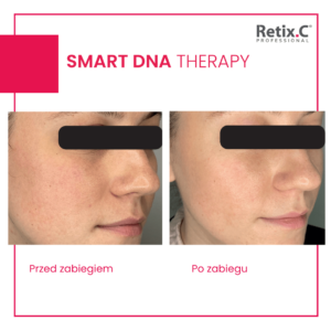 retix-c-smart-dna-therapy-efekty