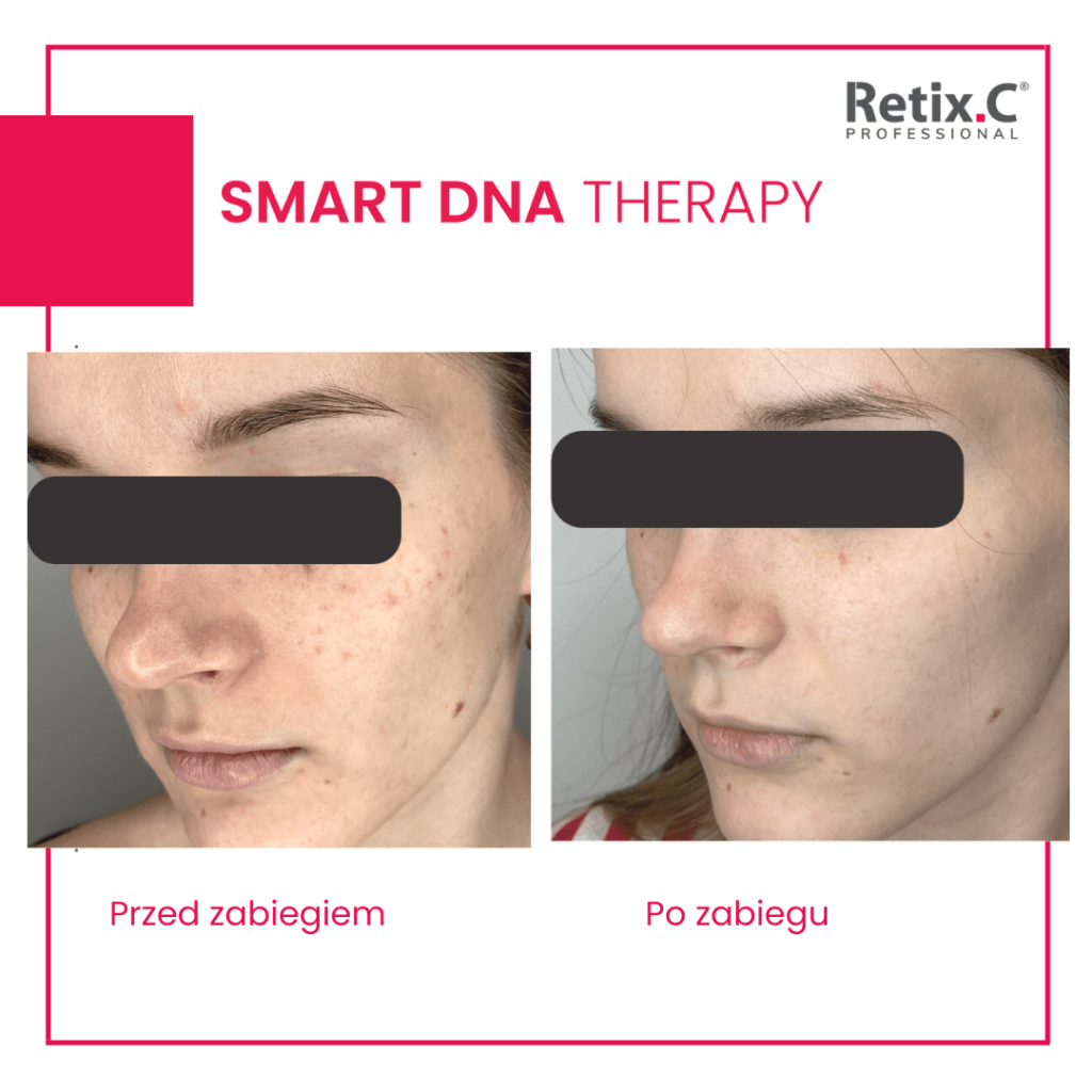 retix-c-smart-dna-therapy-efekty